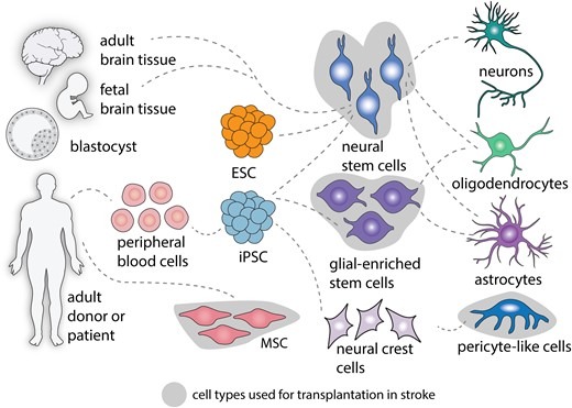 圖2：中風后細胞治療的細胞類型。