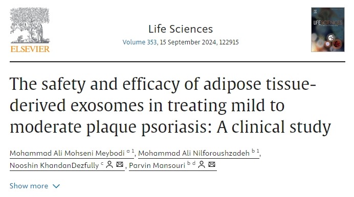脂肪組織衍生外泌體治療輕中度斑塊狀銀屑病的安全性和有效性:一項臨床研究 脂肪組織衍生外泌體治療輕中度斑塊狀銀屑病的安全性和有效性:一項臨床研究