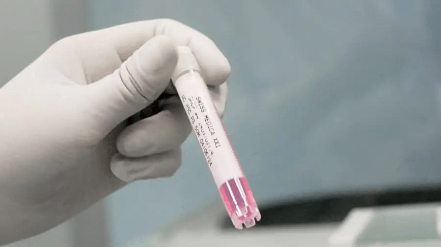 干細(xì)胞治療程序:??完整流程和所有步驟!