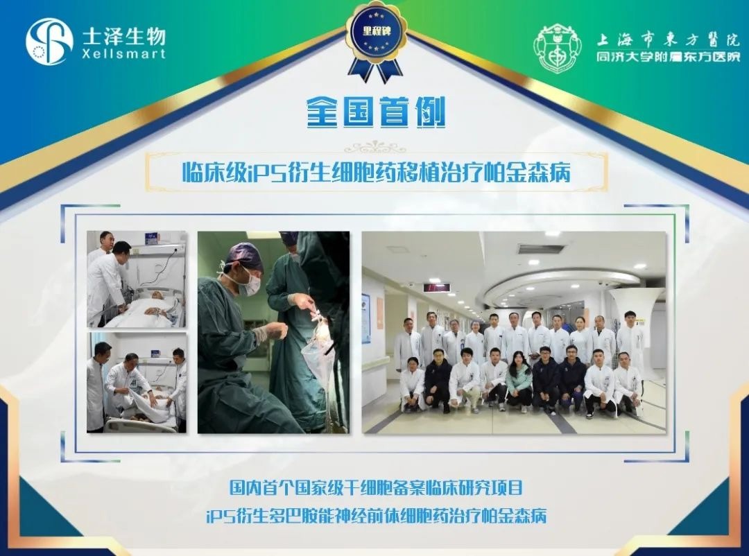 臨床級iPSC衍生多巴胺能神經前體細胞治療中重度帕金森病 臨床級iPSC衍生多巴胺能神經前體細胞治療中重度帕金森病