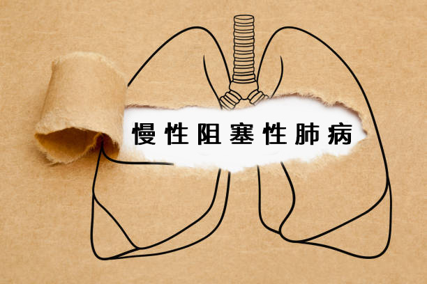 2024年干細胞治療慢阻肺的最新研究進展盤點 2024年干細胞治療慢阻肺的最新研究進展盤點