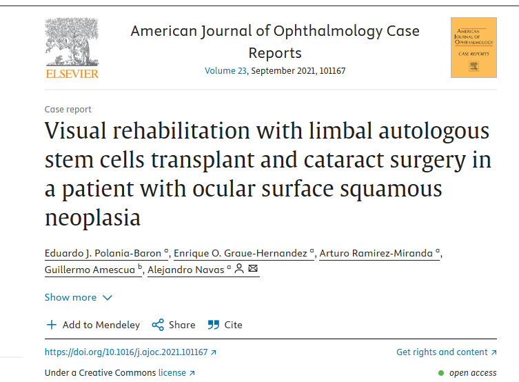 眼表鱗狀細胞瘤患者角膜緣自體干細胞移植及白內障手術進行視力康復