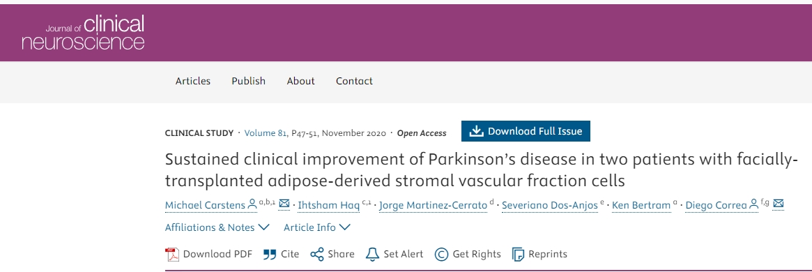 面部移植間充質(zhì)干細(xì)胞治療2例帕金森病患者，患者臨床癥狀持續(xù)改善