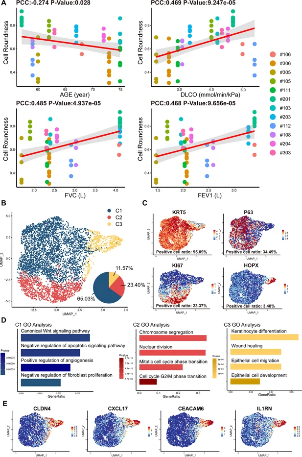 圖2:從IPF患者中分離的P63+肺祖細(xì)胞的細(xì)胞形態(tài)和單細(xì)胞RNA測(cè)序分析。 圖2:從IPF患者中分離的P63+肺祖細(xì)胞的細(xì)胞形態(tài)和單細(xì)胞RNA測(cè)序分析。
