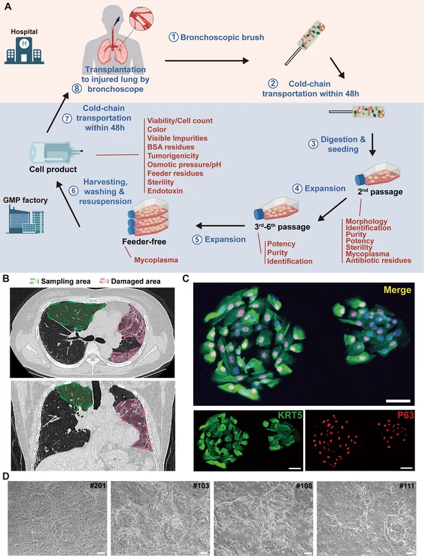 圖1:從IPF患者中分離的P63+肺祖細(xì)胞的克隆和表征。 圖1:從IPF患者中分離的P63+肺祖細(xì)胞的克隆和表征。