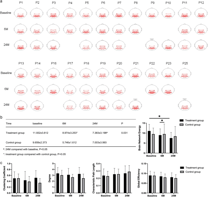 腦功能網絡分析 腦功能網絡分析