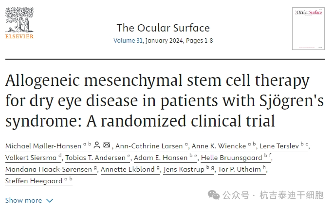 異體間充質干細胞療法治療斯約格倫綜合征患者的干眼癥:隨機臨床試驗 異體間充質干細胞療法治療斯約格倫綜合征患者的干眼癥:隨機臨床試驗