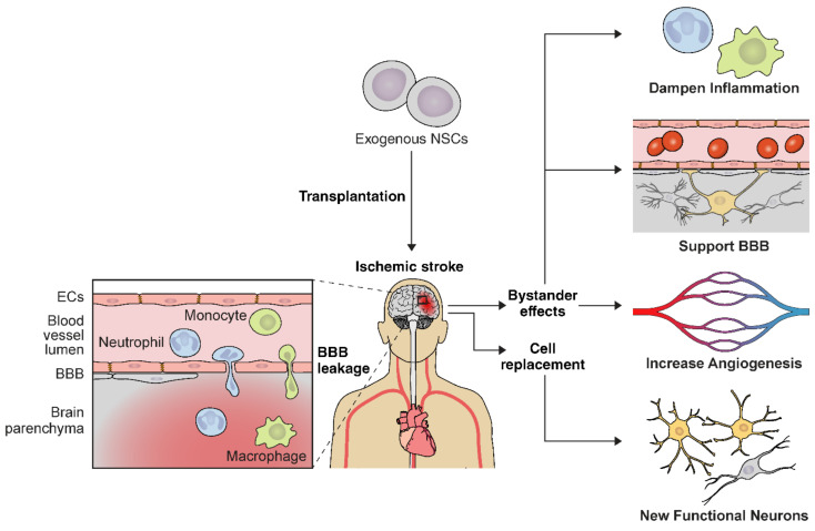 圖2:NSC輸送示意圖,說明缺血性中風的多種治療機制。 圖2:NSC輸送示意圖,說明缺血性中風的多種治療機制。
