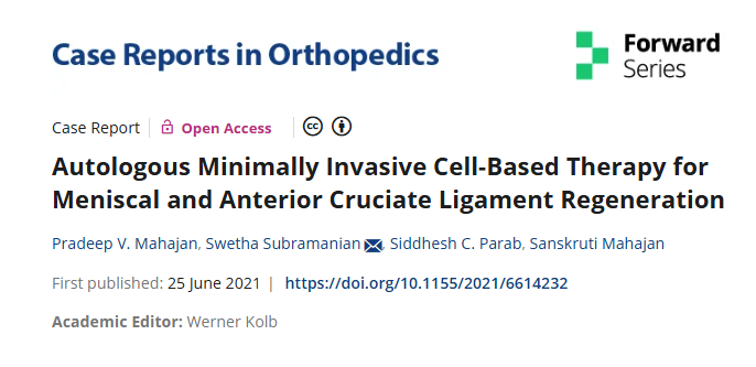 自體微創(chuàng)細胞療法治療半月板和前交叉韌帶再生