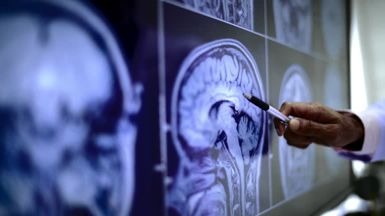 綜述:談?wù)勯g充質(zhì)干細(xì)胞治療中風(fēng)的機(jī)制、案例及未來發(fā)展方向 綜述:談?wù)勯g充質(zhì)干細(xì)胞治療中風(fēng)的機(jī)制、案例及未來發(fā)展方向