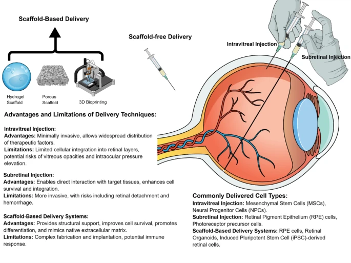 圖4:用于眼部治療的干細胞遞送技術包括無支架系統和基于支架的系統。玻璃體內注射和視網膜下注射等方法在療效、安全性和整合性方面各有不同。