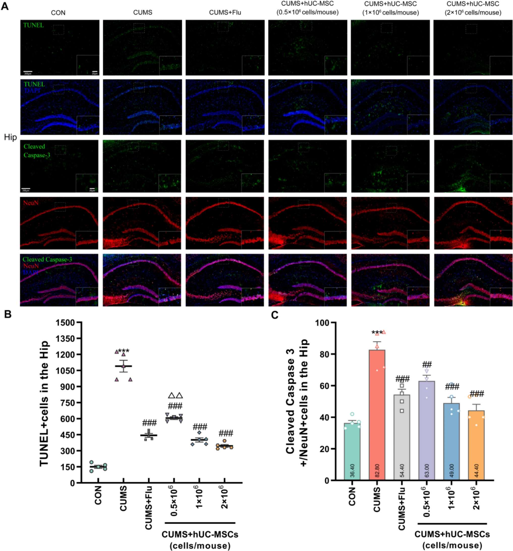 圖2:hUC-MSCs減輕了CUMS小鼠海馬 (Hip) 中的神經元損傷 圖2:hUC-MSCs減輕了CUMS小鼠海馬 (Hip) 中的神經元損傷