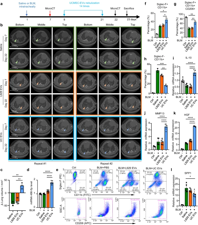 圖3:EVs在肺纖維化治療中的作用。 圖3:EVs在肺纖維化治療中的作用。
