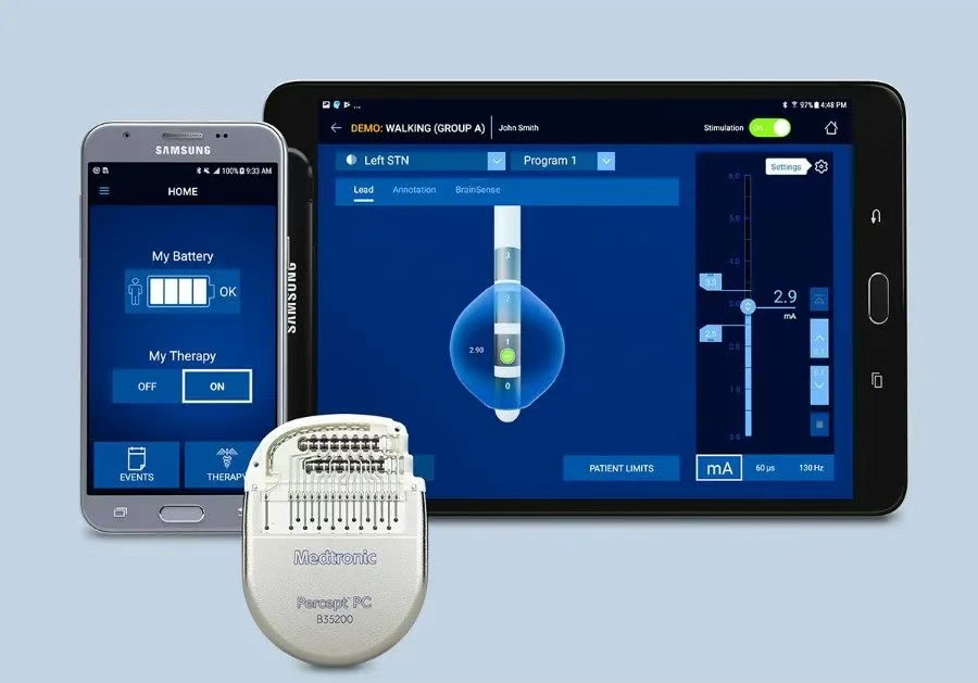 美敦力推出的BrainSense?自適應(yīng)腦深部刺激(aDBS)系統(tǒng) 美敦力推出的BrainSense?自適應(yīng)腦深部刺激(aDBS)系統(tǒng)