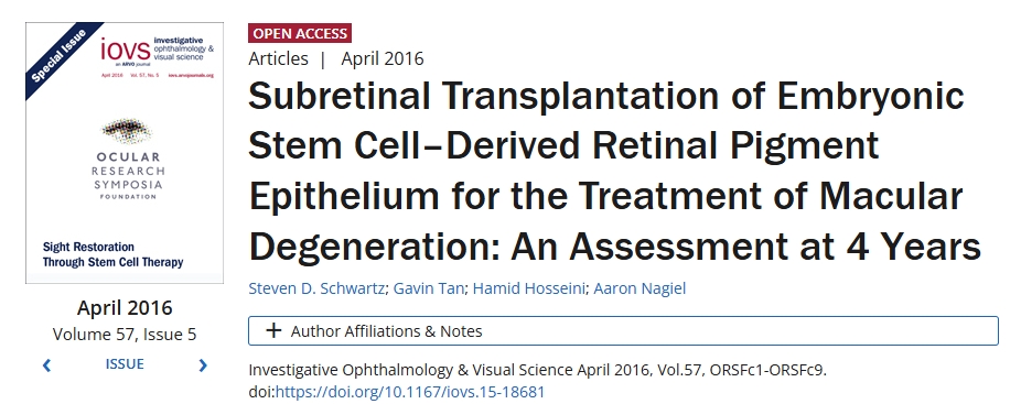 胚胎干細(xì)胞來源的視網(wǎng)膜色素上皮視網(wǎng)膜下移植治療黃斑變性:4年評估 胚胎干細(xì)胞來源的視網(wǎng)膜色素上皮視網(wǎng)膜下移植治療黃斑變性:4年評估