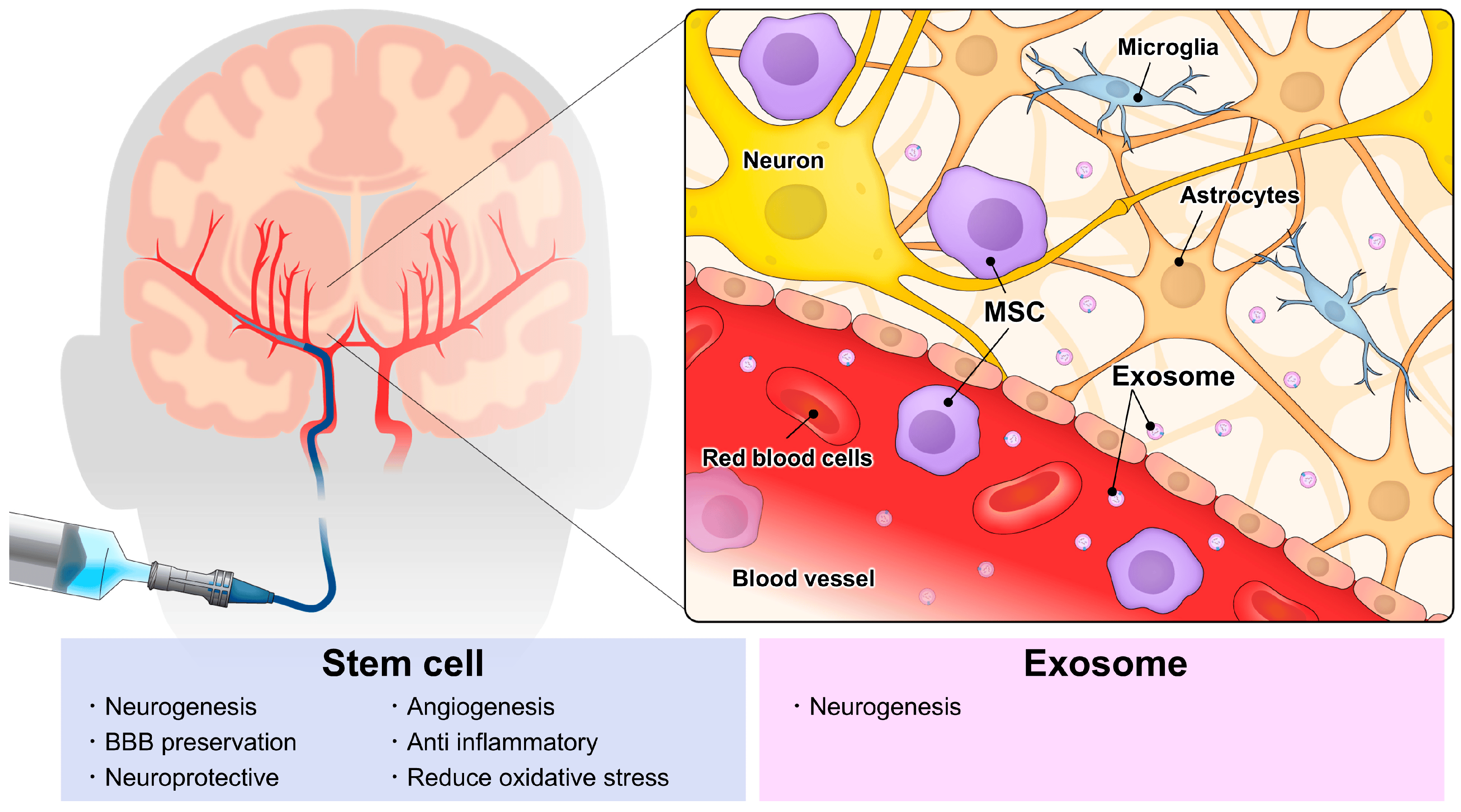 動脈注射干細胞&外泌體治療神經(jīng)系統(tǒng)疾病,打多少細胞合適?什么時候移植好? 動脈注射干細胞&外泌體治療神經(jīng)系統(tǒng)疾病,打多少細胞好?