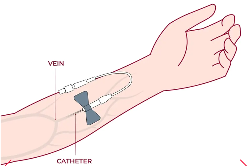 細胞通過靜脈輸注進行給藥，在某些情況下，可以使用其他輸送方法（例如鼻噴霧劑或局部應用）來針對特定系統。