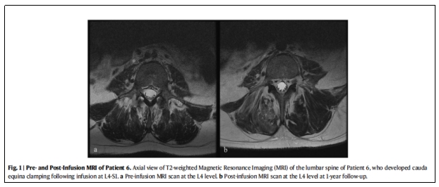 臨床試驗 臨床試驗