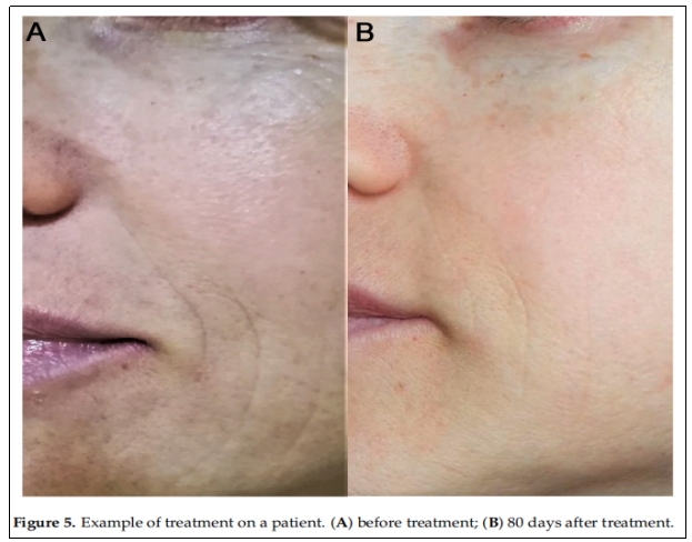 臨床試驗(yàn) 臨床試驗(yàn)