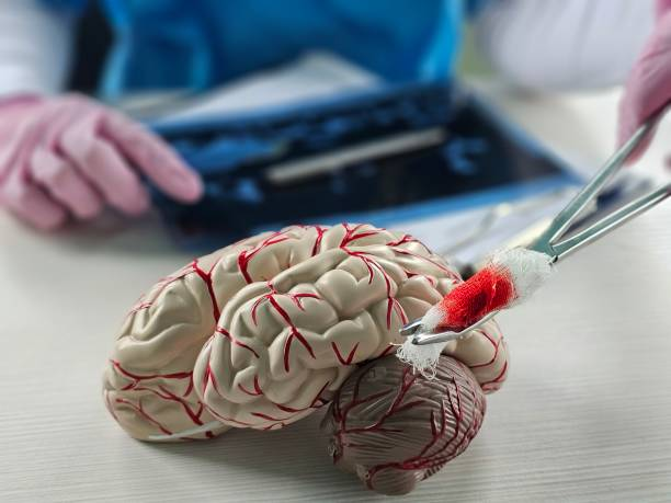 “開關現象”能解決？干細胞為帕金森病治療帶來新希望