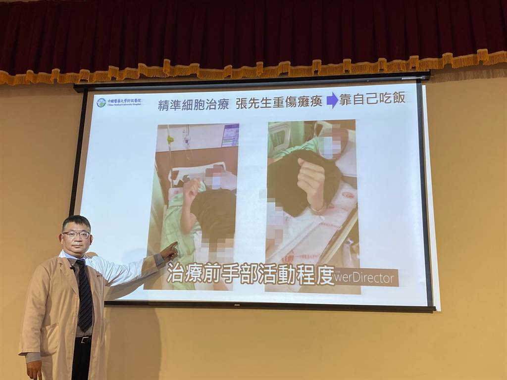 干細胞治療前 干細胞治療前