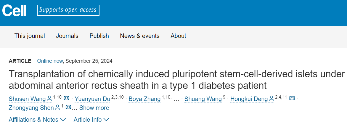 在一名1型糖尿病患者腹部前直肌鞘下移植化學(xué)誘導(dǎo)的多能干細(xì)胞來源胰島 在一名1型糖尿病患者腹部前直肌鞘下移植化學(xué)誘導(dǎo)的多能干細(xì)胞來源胰島