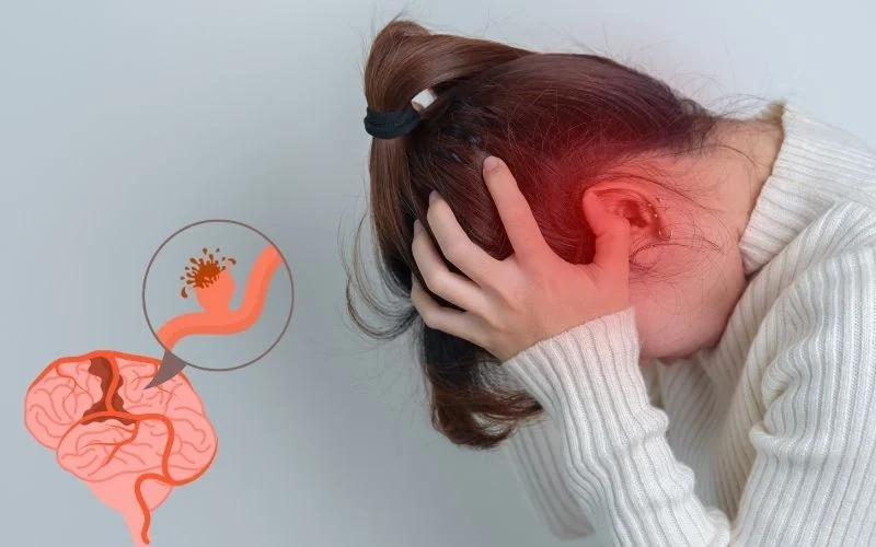 神經(jīng)干細(xì)胞移植治療腦出血:機(jī)制、療效與轉(zhuǎn)化前景