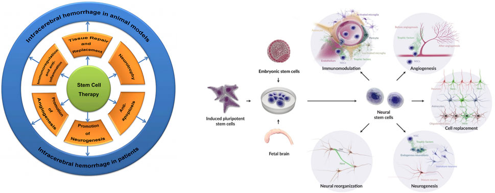 干細(xì)胞和神經(jīng)干細(xì)胞在腦出血中的治療機(jī)制