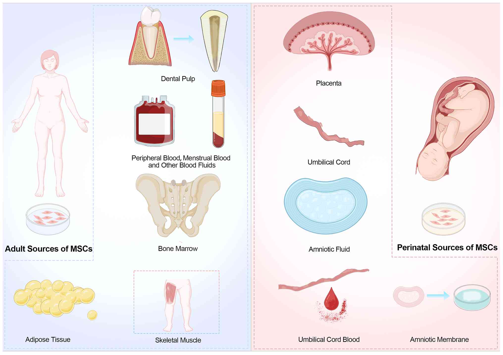 圖2:間充質(zhì)干細(xì)胞的來源。成人間充質(zhì)干細(xì)胞可來源于骨髓、脂肪組織、外周血、骨骼肌和牙髓。圍產(chǎn)期間充質(zhì)干細(xì)胞通常取自胎盤、臍帶、臍帶血、羊水和羊膜。 圖2:間充質(zhì)干細(xì)胞的來源。成人間充質(zhì)干細(xì)胞可來源于骨髓、脂肪組織、外周血、骨骼肌和牙髓。圍產(chǎn)期間充質(zhì)干細(xì)胞通常取自胎盤、臍帶、臍帶血、羊水和羊膜。